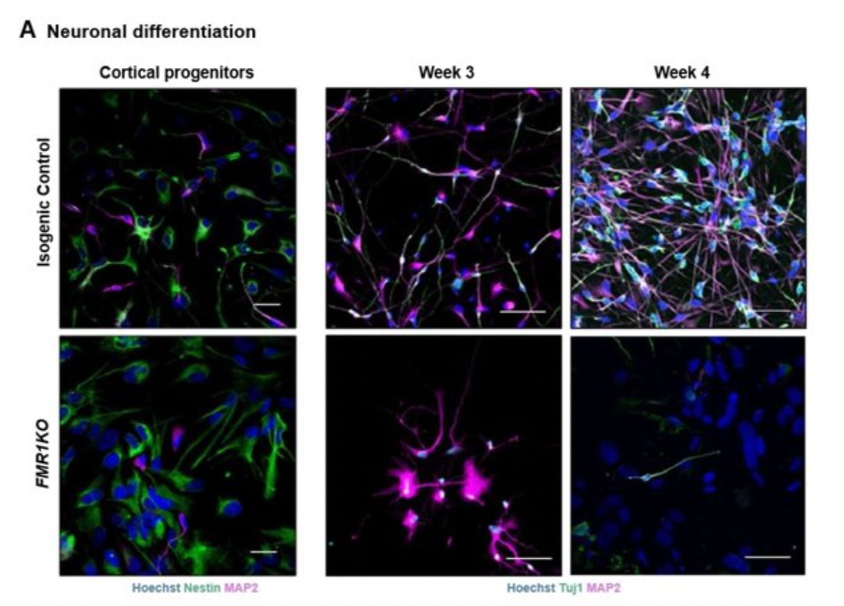 Série de figures de microscopie à fluorescence tirées de l'article de Gilles Maussion.