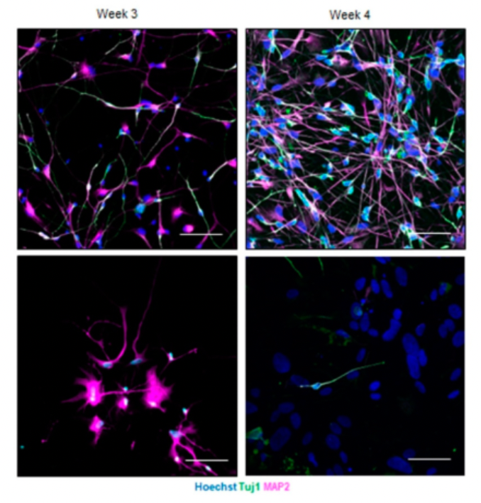 Image that represents the paper: Transcriptional dysregulation and impaired neuronal activity in FMR1 knock-out and Fragile X patients’ iPSC-derived models