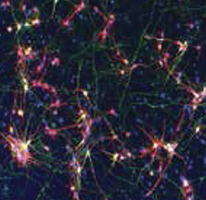 Microscopy of neurons from Fiesel's paper.