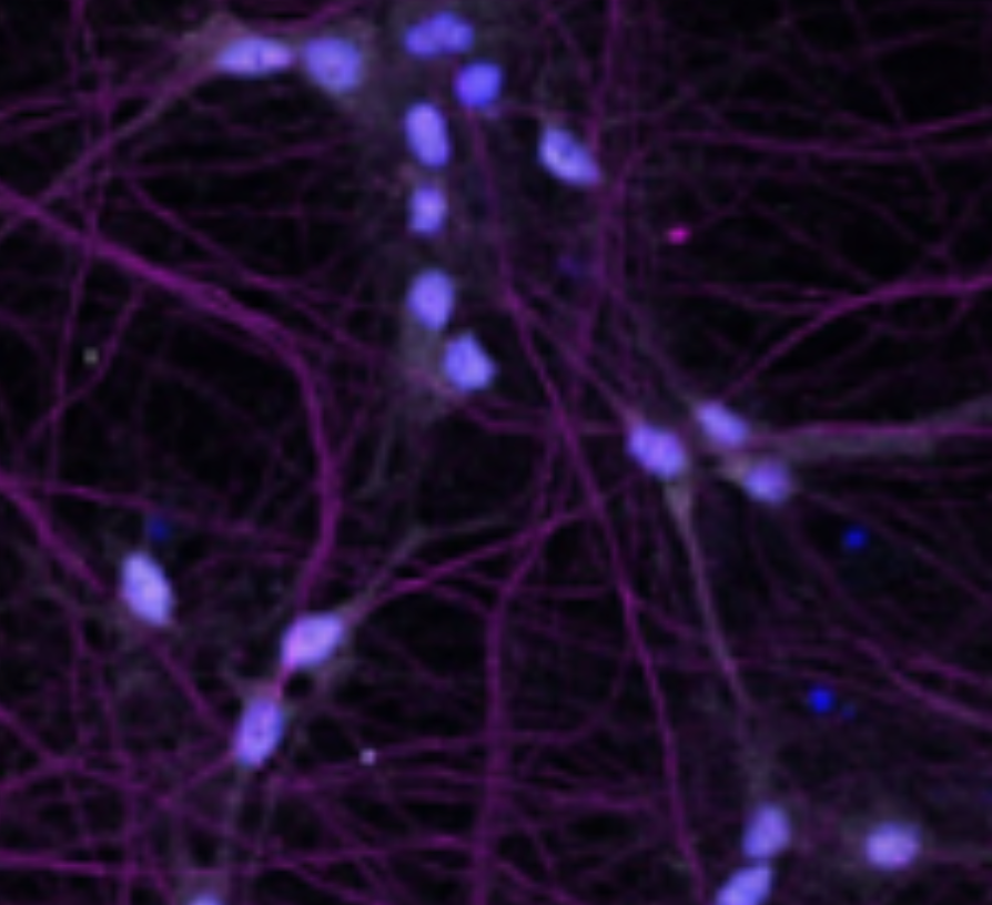 Microscopy of motor neurons from Sarah Lepine's paper.