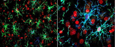 Cellules microgliales humaines obtenues à partir de SCPi, transplantées dans le cortex d’une souris et colorées par des anticorps anti-P2YR12 et anti-TMEM119, spécifiques de la cellule microgliale (en vert).
