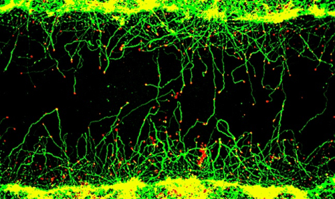 Treatment with fusicoccin-A induces the regeneration of damaged axons towards the center of the injury. The axons are stained in green and the tips of the growing axons, called growth cones, are stained in red.