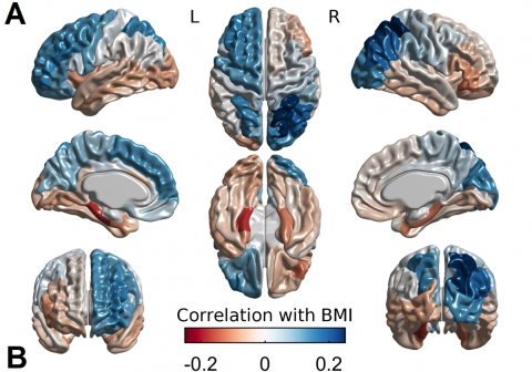How cortical thickness associates with BMI. Body mass index relates positively with cortical thickness in blue areas, and negatively with cortical thickness in red areas. 