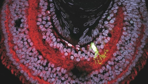 Tadpole eye stained to reveal cannabinoid receptors (red). A single fluorescently labeled cell (green) is shown at greater magnification to the right (courtesy Dr. Loïs Miraucourt)