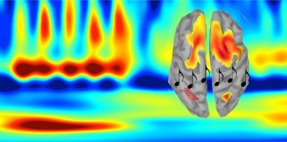 La SMT améliore la mémoire auditive. Ce type de stimulation pourrait un jour permettre de compenser la perte de mémoire attribuable à des maladies neurodégénératives, comme la maladie d’Alzheimer.