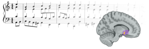 The researchers found that reward prediction errors from music correlated with activity in the nucleus accumbens, a brain region that in previous studies has been shown to activate when the subject is experiencing musical pleasure. The researchers found that reward prediction errors from music correlated with activity in the nucleus accumbens, a brain region that in previous studies has been shown to activate when the subject is experiencing musical pleasure.