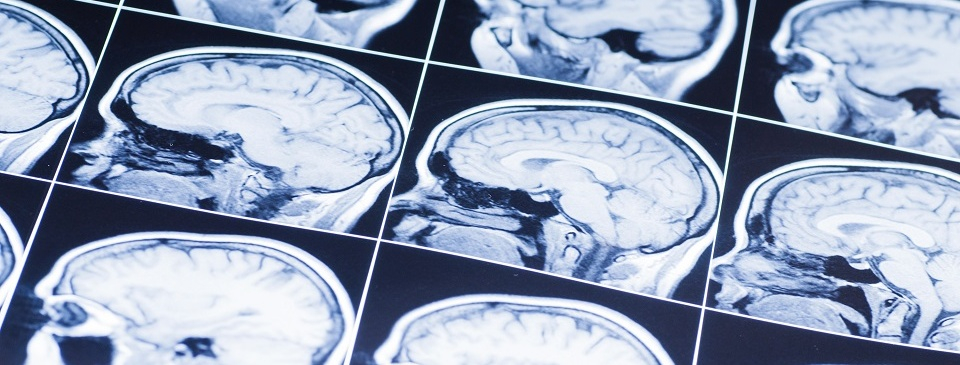 brain x-ray