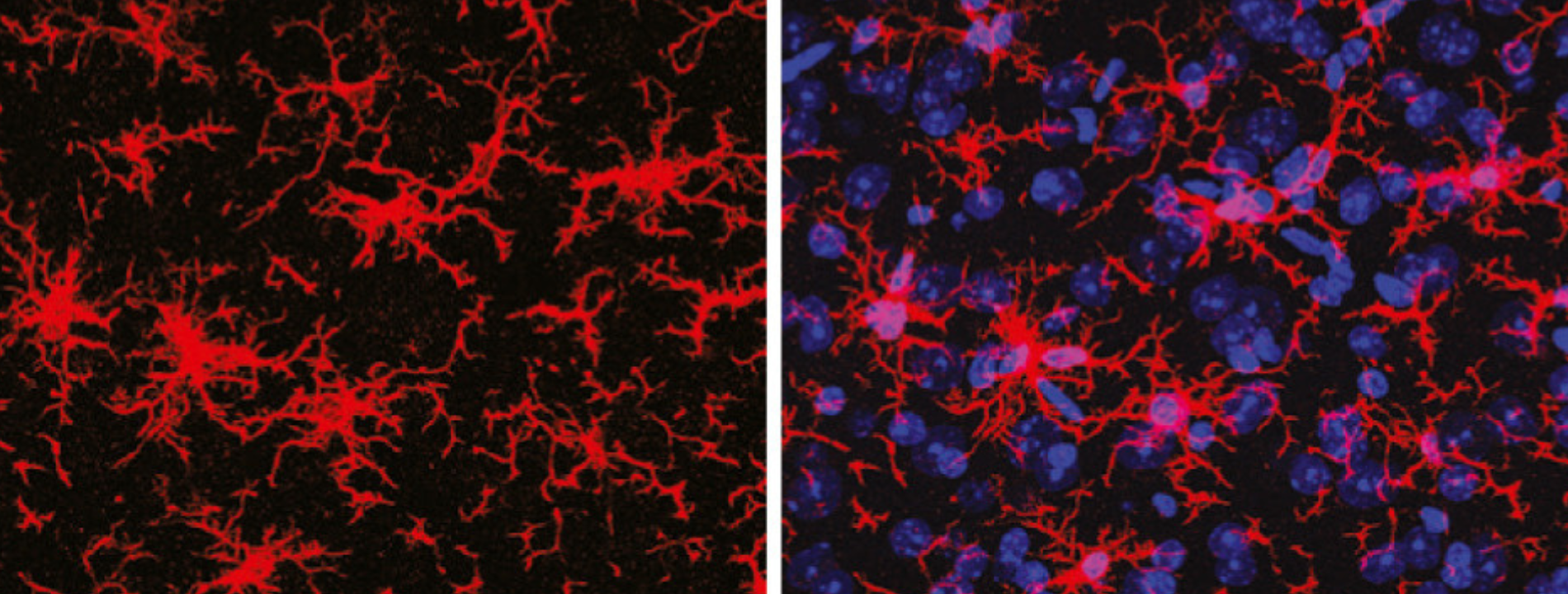 High-magnification images of microglia, in the control (left) and treated (right) experimental models.
