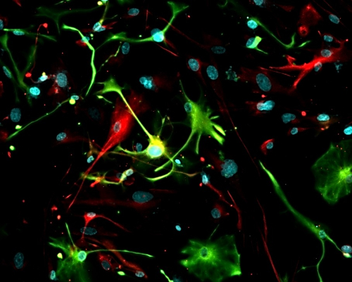astrocytes