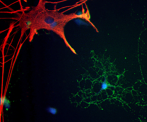 Astrocyte and an oligodendrocyte
