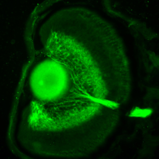 The eye of a transgenic Xenopus tadpole expressing green fluorescent protein in the retinal ganglion cells of the retina.