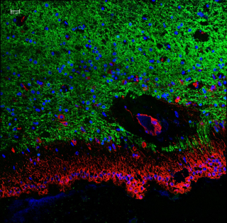 Image of the ventricular lining in a healthy brain showing ependymal cells (red), microglia (green) and nuclei (blue). Image produced by immunohistochemistry and seen through a microscope.