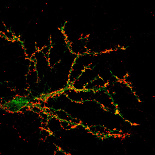 Dendrites with synapses marked red