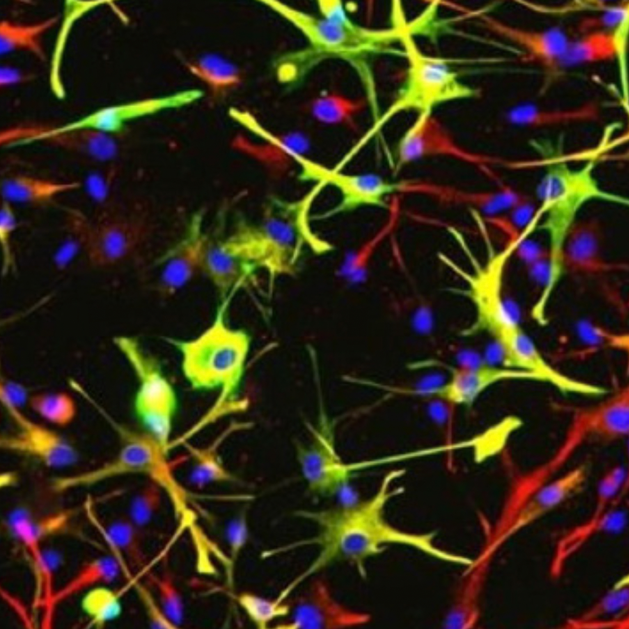 Microscopie d'astrocytes réalisée par le scientifique Vincent Soubannier.