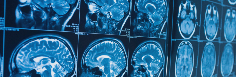 Brain scans