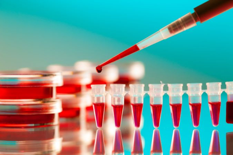 Blood tests