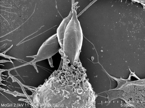 Parasite Leishmania (top centre) being ingested by a macrophage – an immune cell at the front lines of our body's defense against foreign invaders.