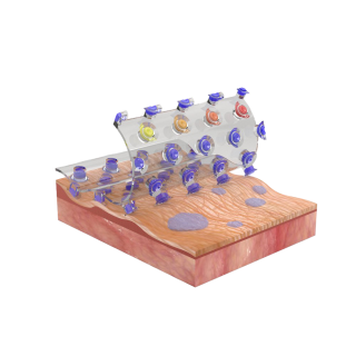 Schematic illustration of the adhesive patch with diving beetle-inspired suction chambers against rough and wet human skin.