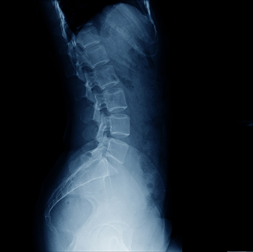 Xray of back