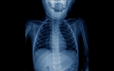Pediatric Orthopaedics X-ray