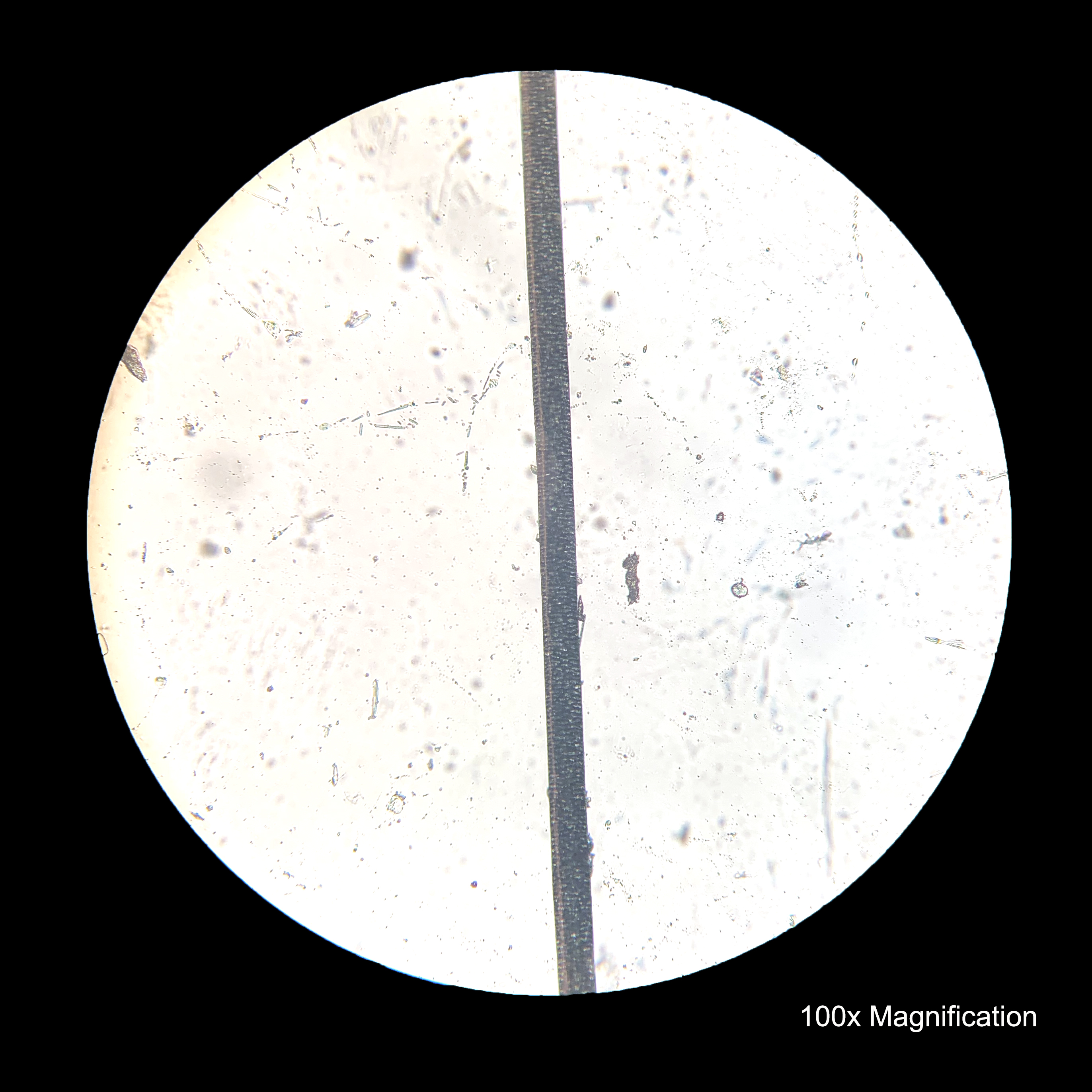 a human hair under microscope