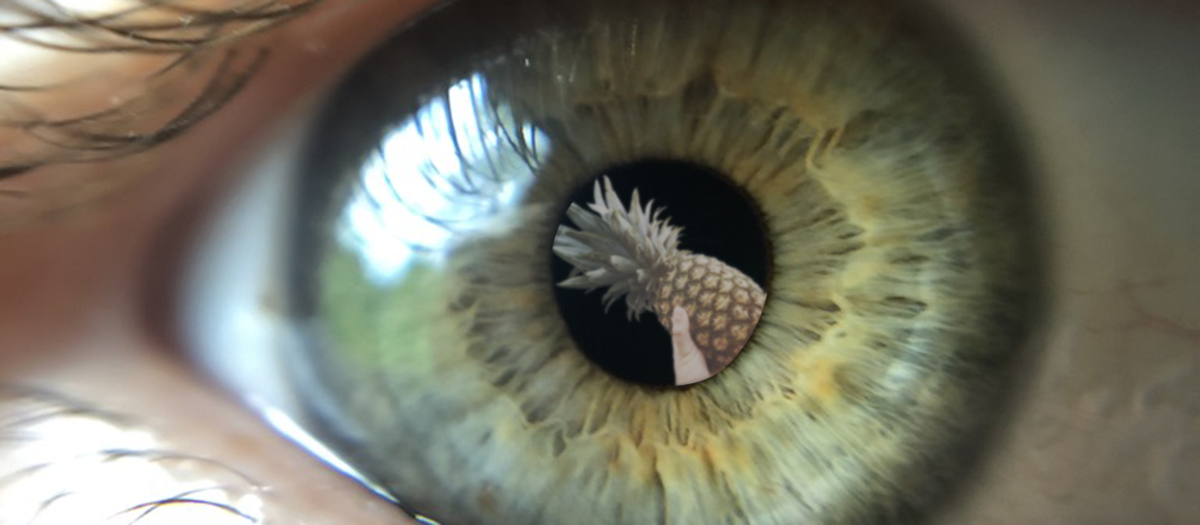 Pineapple for Eye Floaters: Sweet Deal or Pipe Dream?