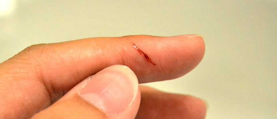 Paper cuts - here's why they hurt so much