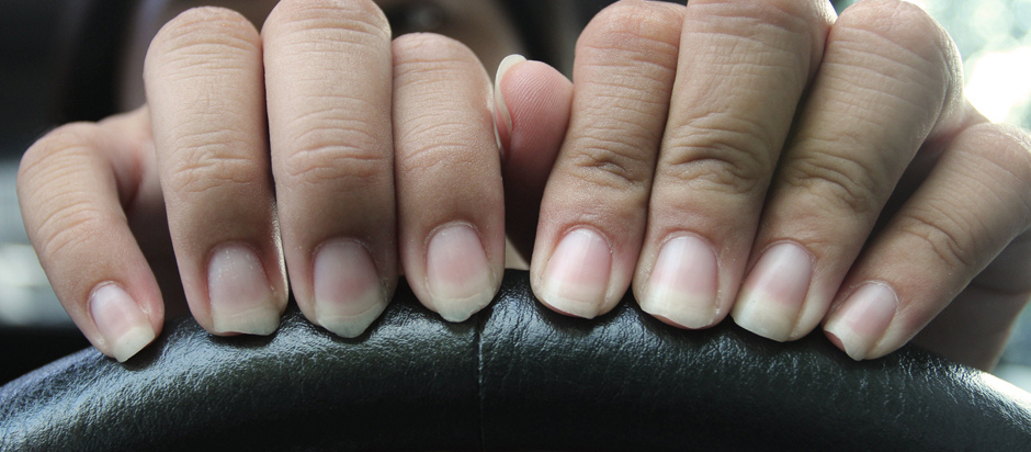 Do discoloured nails mean something? | Office for Science and Society -  McGill University
