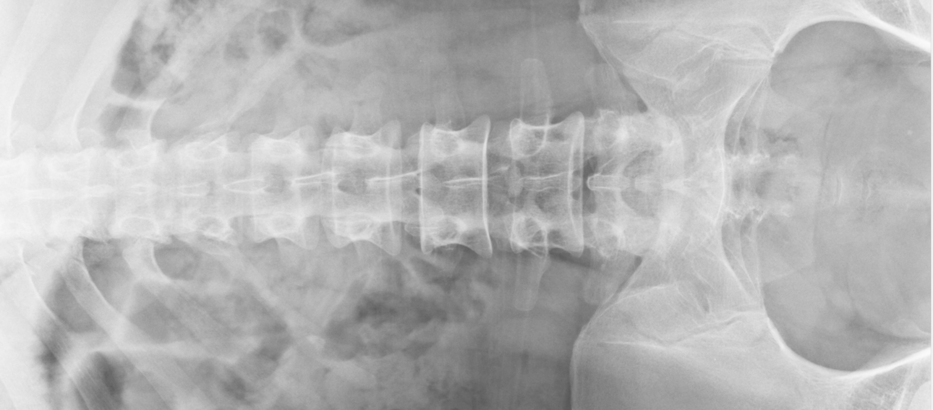 Abdominal x-ray.