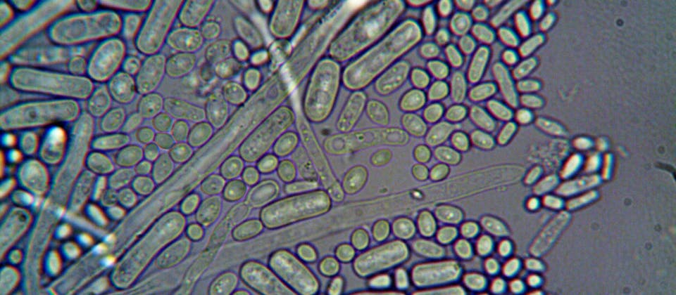 close up of microorganisms