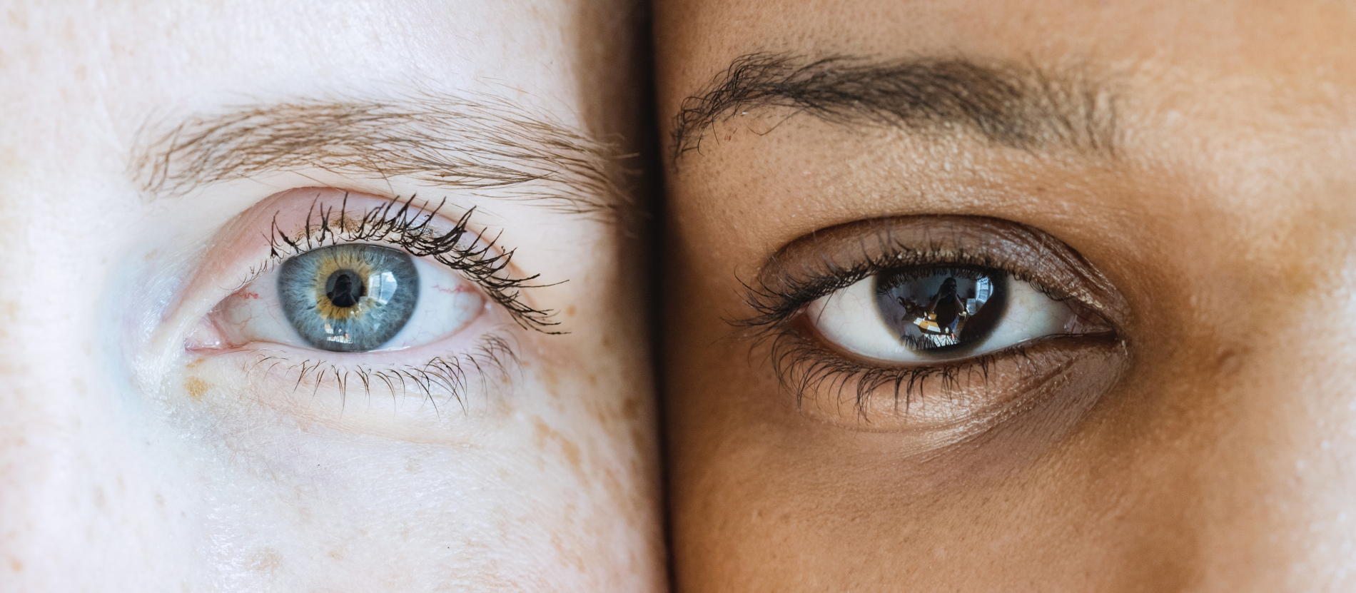 close up of the eyes of twins with different skin colours