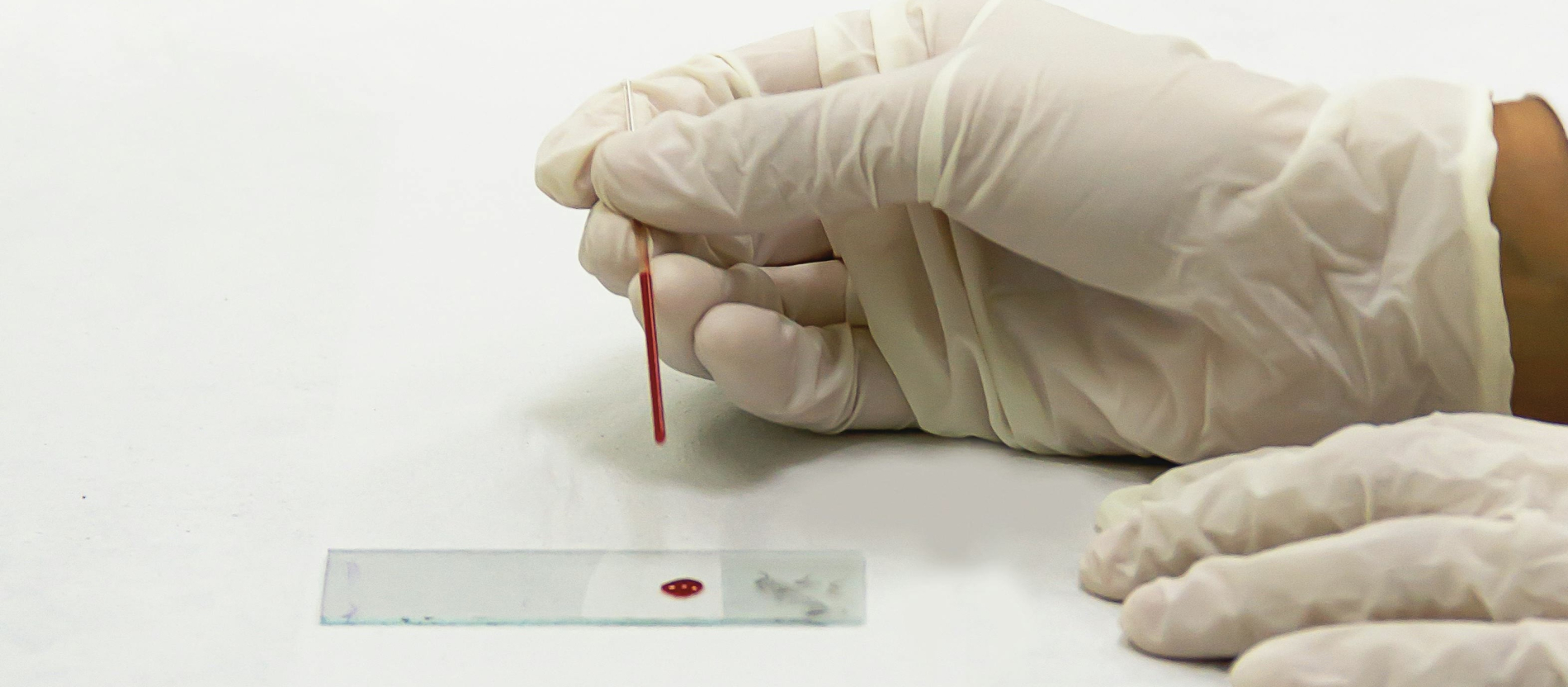 Gloved hands performing a blood smear.
