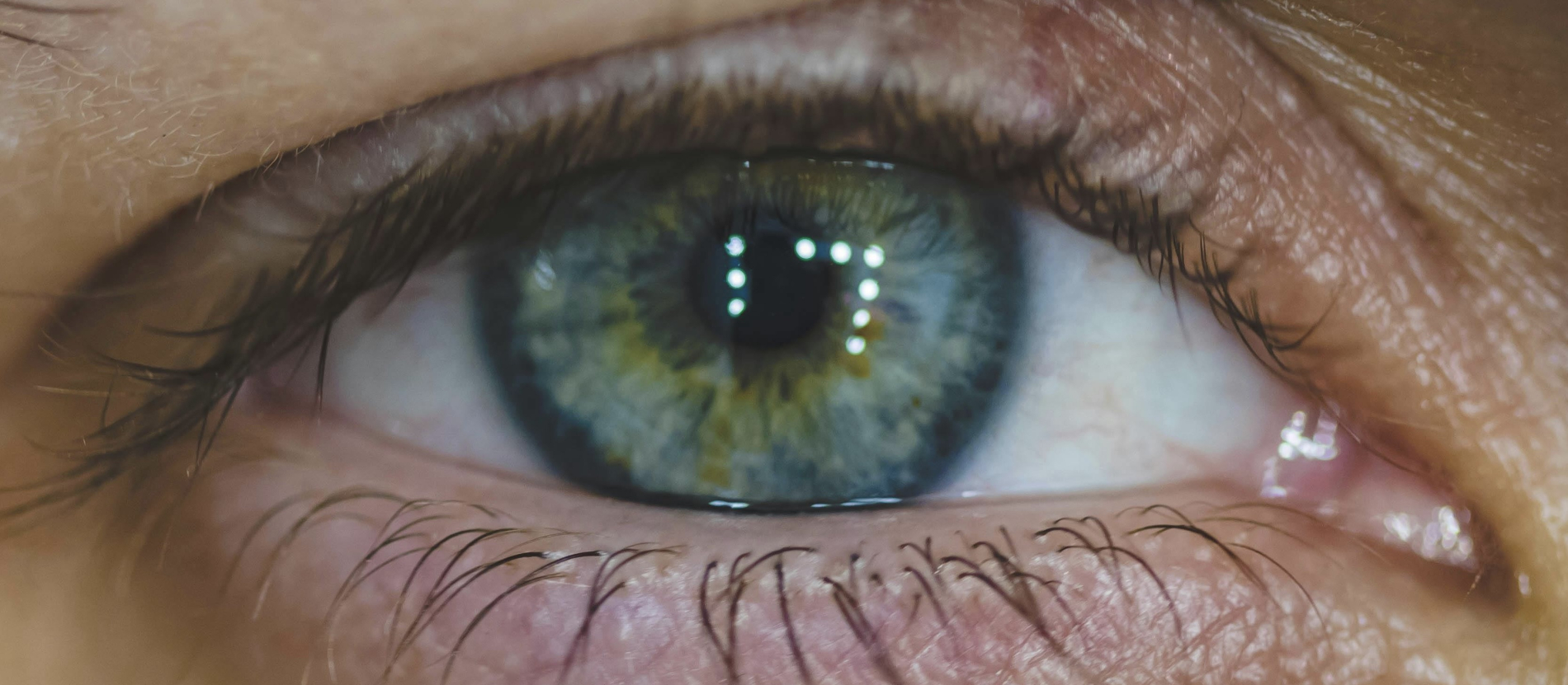 Close-up of blue-green eye with constricted pupil.