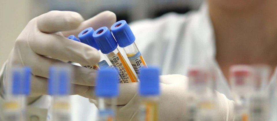 scientist inspecting vials of patient samples