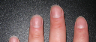 Why Do Nails Have Ridges? | Office for Science and Society - McGill University Why Do Nails Have Ridges? | Office for Science and Society - McGill University