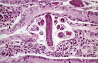 Pathology