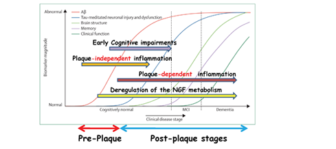 theoretical model of how Alzheimer’s disease alters