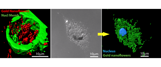 Gold nanoflowers in tumor cells and microglia