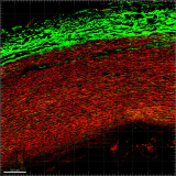 Second Harmonic and two-photon fluorescence on human aorta