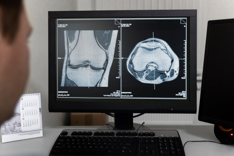 doctor looking at ct scans on computer