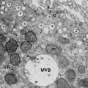 cauda epididymis