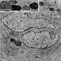 principal cell cauda epididymis