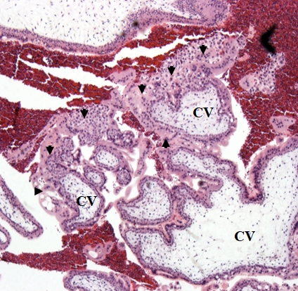 Microscopic view of chorionic villi