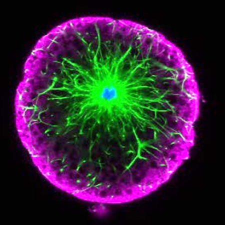 KHDC3L (magenta) and gamma-tubulin (green) expression in an oocyte 