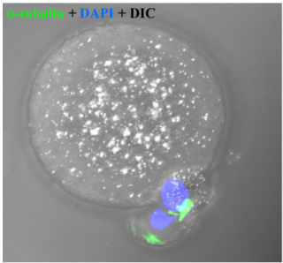 Photo of an empty oocyte