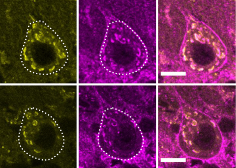 Brain cells in mouse models for spinocerebellar ataxia type 6